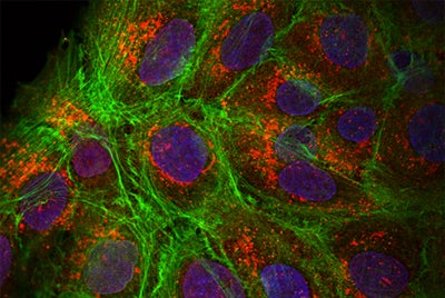 Image of tumor cells stained for actin (green), HAI-2 (red), and DNA (blue)