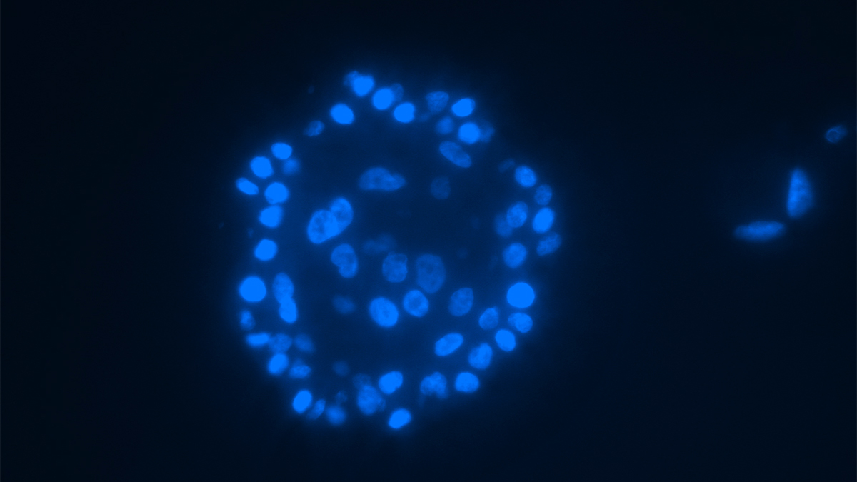 A microscopic image showing breast cells in blue on a black background