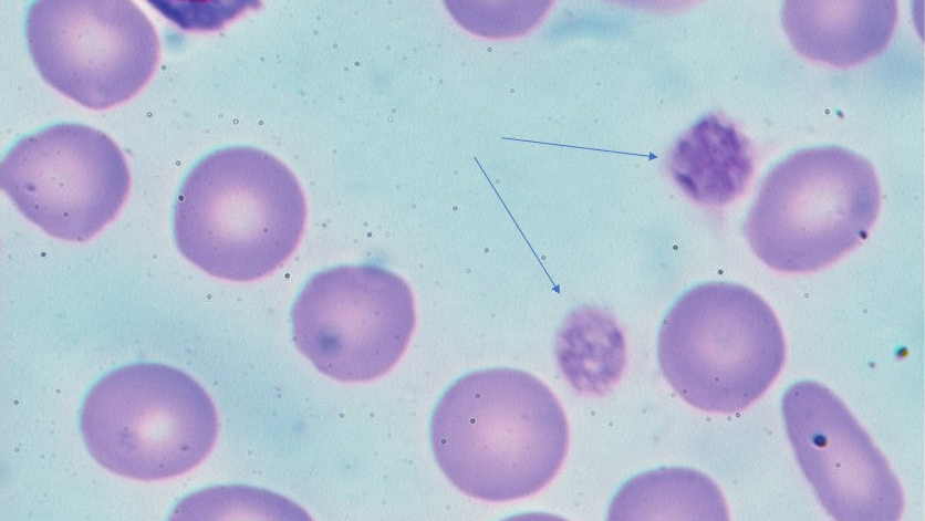 A photomicrograph of blood platelets