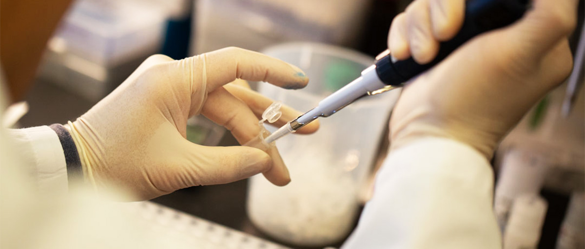 A closeup of hands using a pipette to transfer a lab sample